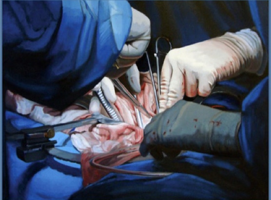 A 44% Increase; Report Does Not Prove Causality; Number of General Surgeons Decrease